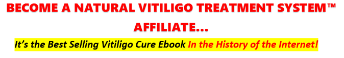 vitiligo affiliate